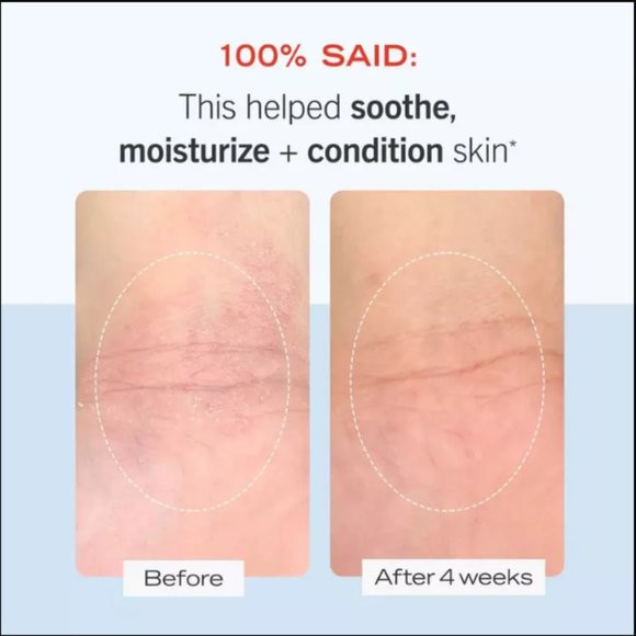 🔥3/$30 NEW FIRST AID BEAUTY FAB Ultra Repair Cream Intense Hydration Dry Skin - Picture 4 of 5